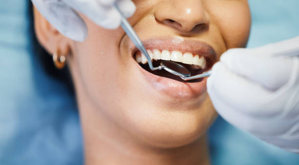 Best Emergency Dentist for Lost Fillings or Crowns in Alton, TX